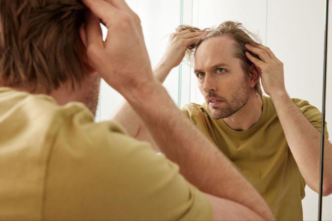 Hair loss treatment